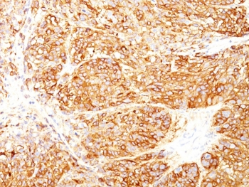 Melanoma Marker Antibody Cocktail (MART-1 & gp100)