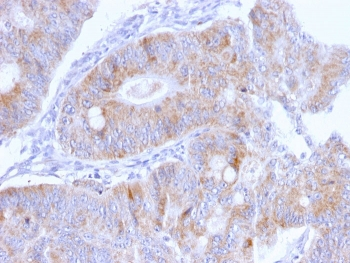 Thomsen-Friedenreich Antigen Antibody / CD176