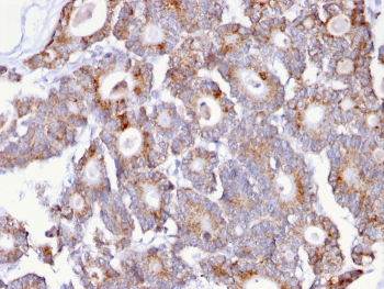 Thomsen-Friedenreich Antigen Antibody / CD176