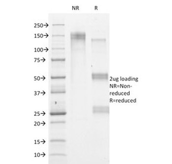 HSV1 Antibody / Herpes Simplex Virus Type I