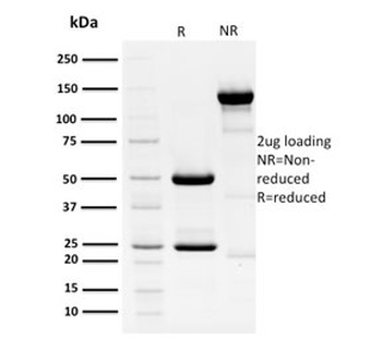HPV-16 E1/E4 Antibody