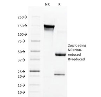 Aurora B Antibody / AURKB