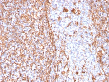 Vimentin Antibody