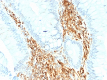 Vimentin Antibody