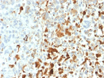 Vimentin Antibody