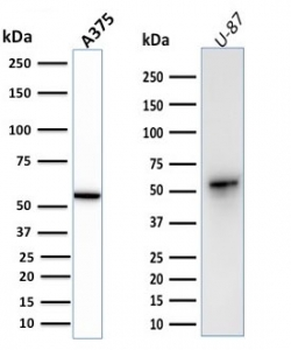 Vimentin Antibody