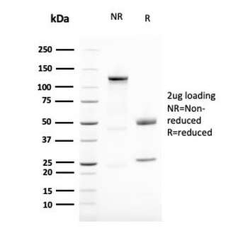 Vimentin Antibody