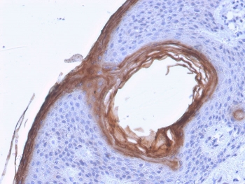 Kallikrein 5 Antibody / KLK5