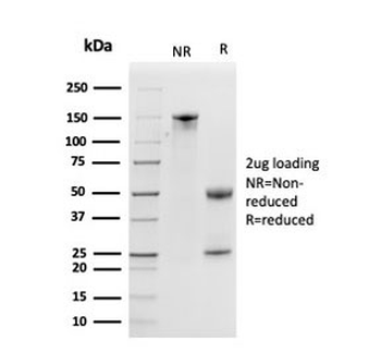 Kallikrein 5 Antibody / KLK5