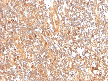 GCLM Antibody / Glutamate-Cysteine Ligase Regulatory Subunit