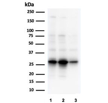 GCLM Antibody / Glutamate-Cysteine Ligase Regulatory Subunit