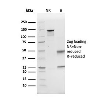 GCLM Antibody / Glutamate-Cysteine Ligase Regulatory Subunit
