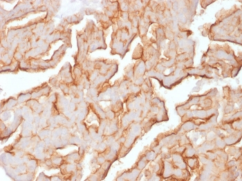 MUC16 Antibody / CA125