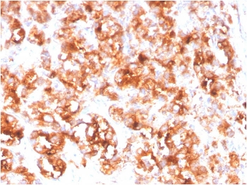 Folate Hydrolase 1 Antibody / FOLH1 / PSMA