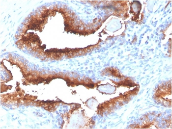 Folate Hydrolase 1 Antibody / FOLH1 / PSMA