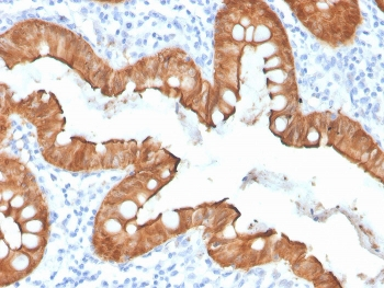 Recombinant Villin Antibody