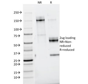 Nidogen Antibody / Entactin