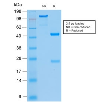 Cytokeratin 8/18 Antibody