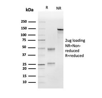 UBE2C Antibody