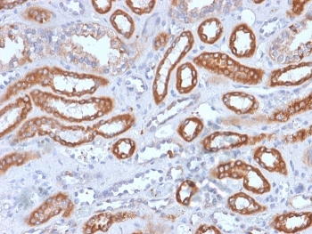 Integrin beta 3 Antibody / ITGB3 / CD61