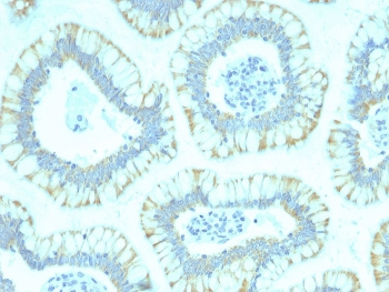 SMAD4 Antibody