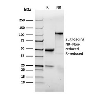 Integrin alpha E Antibody / CD103