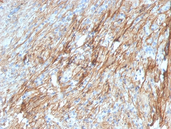FN1 Antibody / Fibronectin