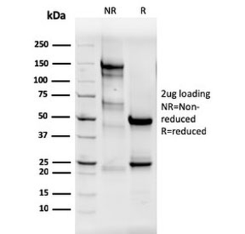 Estrogen Receptor alpha Antibody