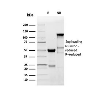 MBP Antibody / Myelin Basic Protein