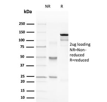 MBP Antibody / Myelin Basic Protein