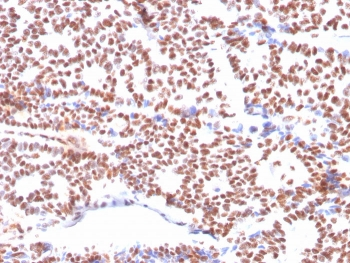 Estrogen Receptor alpha Antibody