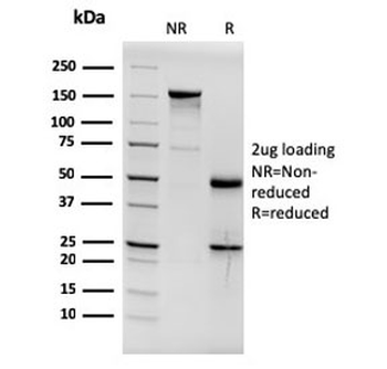 Estrogen Receptor alpha Antibody