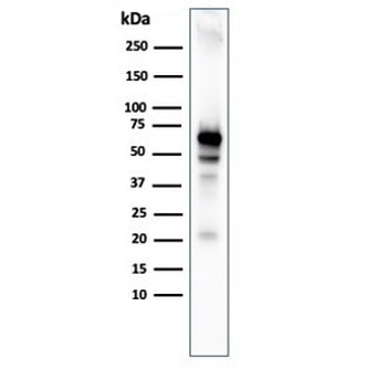 AKT1 Antibody
