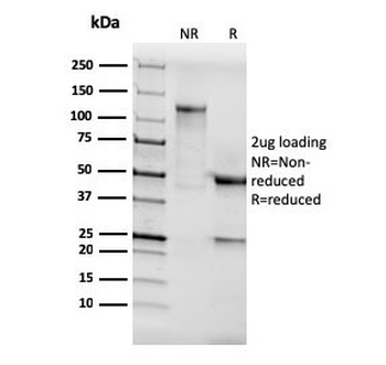 AKT1 Antibody