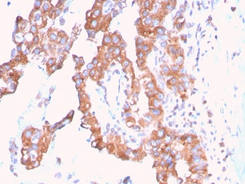 SERBP1 Antibody / PAI-RBP1