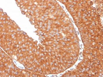 SERBP1 Antibody / PAI-RBP1