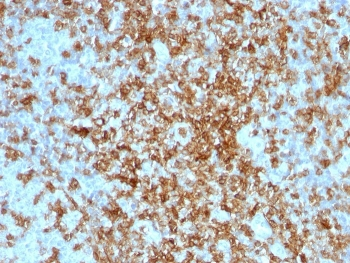 CD43 Antibody