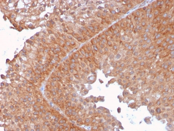 SERBP1 Antibody / PAI-RBP1