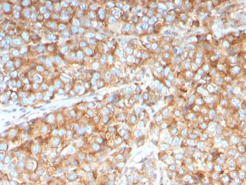 SERBP1 Antibody / PAI-RBP1
