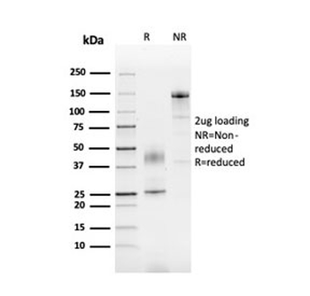 SERBP1 Antibody / PAI-RBP1