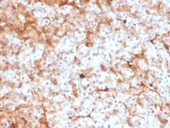 FTL Antibody / Ferritin Light Chain