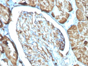 FTL Antibody / Ferritin Light Chain