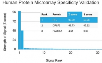 FTL Antibody / Ferritin Light Chain