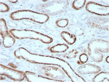 CA9 Antibody / Carbonic Anhydrase IX