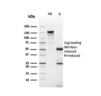 CA9 Antibody / Carbonic Anhydrase IX