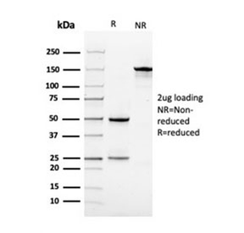 Vinculin Antibody