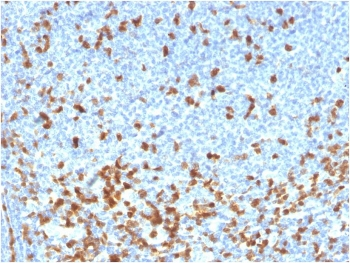 ZAP70 Antibody