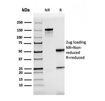 ZAP70 Antibody