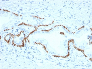 Cytokeratin 5/6 Antibody