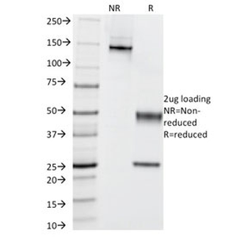 Cytokeratin 5/6 Antibody